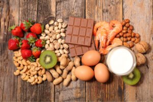 Atlanta food allergy treatment with oral immunotherapy