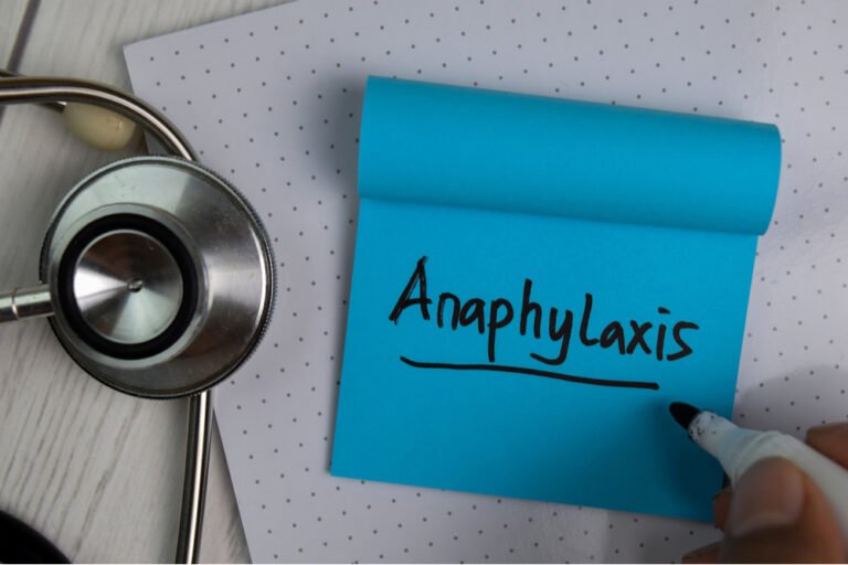 What Causes Anaphylaxis? Food Allergies Atlanta