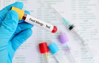 Food allergy testing in Atlanta