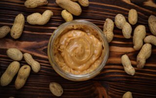 Anaphylaxis from peanut allergies in Atlanta