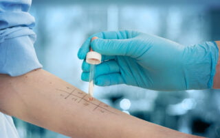 Atlanta food allergy testing