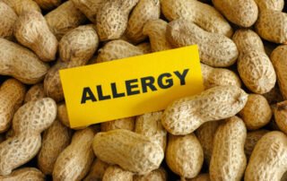 Symptoms of peanut allergies in Atlanta patients