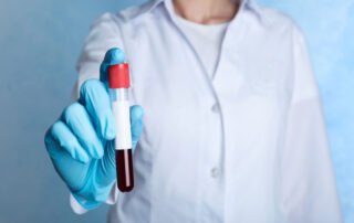 Atlanta blood testing for food allergies