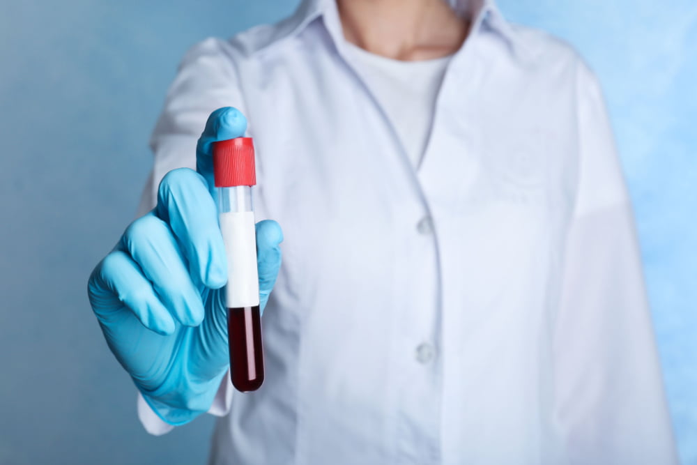 Atlanta blood testing for food allergies