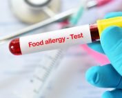Atlanta blood allergy testing for food sensitivities.