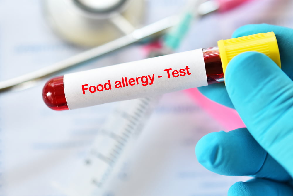 Atlanta blood allergy testing for food sensitivities.