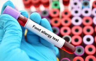 Atlanta blood testing for food allergies.