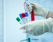 Atlanta blood allergy testing for oral immunotherapy.