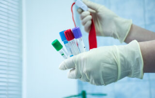 Atlanta blood allergy testing for oral immunotherapy.