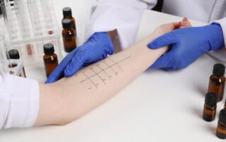 Atlanta skin prick allergy testing.