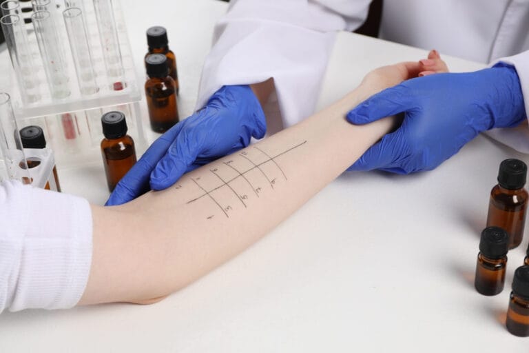 What to Expect During a Skin Prick Allergy Test | Food Allergies Atlanta