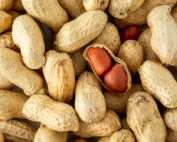 Atlanta peanut allergy diagnosis.