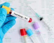 Atlanta food allergy testing.