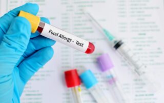 Atlanta food allergy testing.