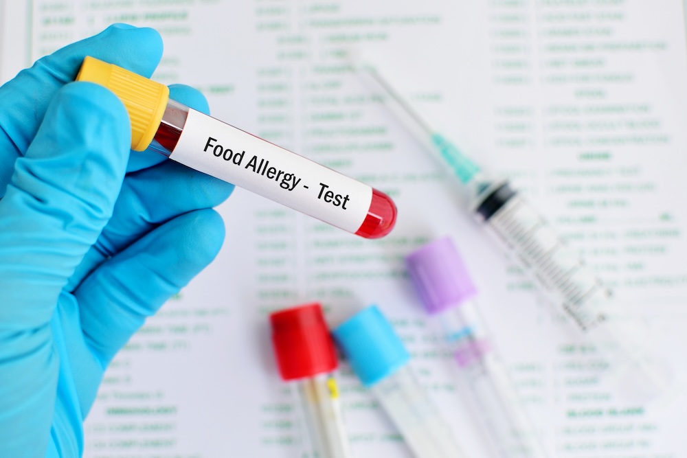 Atlanta food allergy testing.