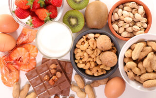 Food allergy testing for multiple allergies in Atlanta.